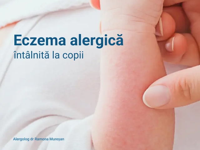 Eczema alergică la copii