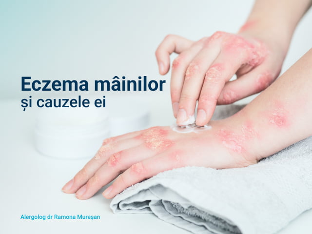 Eczema mâinilor și cauzele ei